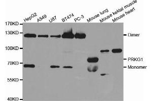 Western blot analysis of extracts of various cell lines, using PRKG1 antibody (ABIN5971390) at 1/1000 dilution. (PRKG1 抗体)