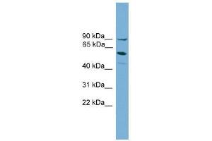 ALOX15B antibody used at 0. (ALOX15B 抗体  (Middle Region))