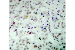 Immunohistochemistry (IHC) image for anti-Retinoblastoma 1 (RB1) (pSer780) antibody (ABIN1870571) (Retinoblastoma 1 抗体  (pSer780))