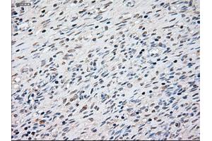 Immunohistochemical staining of paraffin-embedded Ovary tissue using anti-KRT8mouse monoclonal antibody. (KRT8 抗体  (AA 91-381))