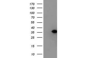 HEK293T cells were transfected with the pCMV6-ENTRY control (Left lane) or pCMV6-ENTRY NUBPL (Right lane) cDNA for 48 hrs and lysed. (NUBPL 抗体  (AA 1-250))