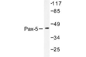 Image no. 1 for anti-Paired Box 5 (PAX5) antibody (ABIN271778) (PAX5 抗体)
