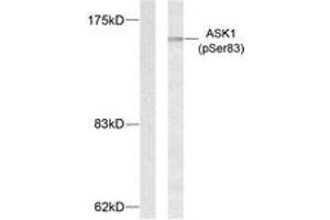 Western blot analysis of extracts from MDA-MB-435 cells treated with TNF-alpha, using ASK1 (Phospho-Ser83) Antibody. (ASK1 抗体  (pSer83))