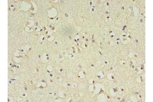 Immunohistochemistry of paraffin-embedded human brain tissue using ABIN7144817 at dilution of 1:100 (ATL3 抗体  (AA 1-187))