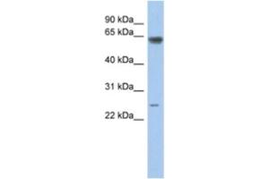 Western Blotting (WB) image for anti-TAF5-Like RNA Polymerase II, P300/CBP-Associated Factor (PCAF)-Associated Factor, 65kDa (TAF5L) antibody (ABIN2463889) (TAF5L 抗体)