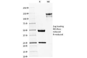 SDS-PAGE Analysis of Purified, BSA-Free Spectrin beta III Antibody (clone SPTBN2/1582). (Spectrin, Beta, Non-erythrocytic 2 (SPTBN2) (AA 356-475) 抗体)