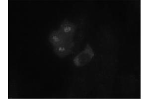 Image no. 1 for anti-Budding Uninhibited By Benzimidazoles 1 Homolog (Yeast) (BUB1) antibody (ABIN341032) (BUB1 抗体)