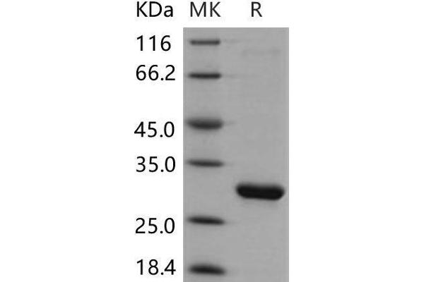 HPGD Protein (His tag)