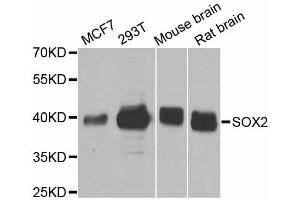 Western blot analysis of extracts of various cell lines, using SOX2 antibody. (SOX2 抗体)