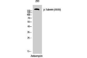 Western Blotting (WB) image for anti-Tuberous Sclerosis 2 (TSC2) (pSer939) antibody (ABIN3182562) (Tuberin 抗体  (pSer939))