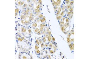 Immunohistochemistry of paraffin-embedded human stomach using TMEM43 antibody. (TMEM43 抗体)