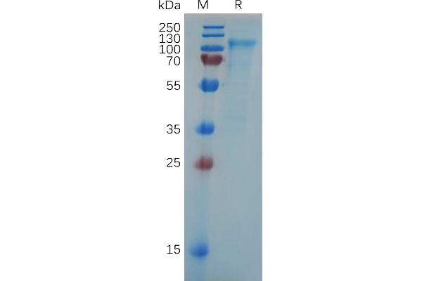 SLC4A7 Protein (AA 1-608) (His tag)