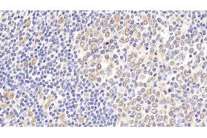 Detection of HSPA8 in Human Tonsil Tissue using Polyclonal Antibody to Heat Shock 70 kDa Protein 8 (HSPA8) (Hsc70 抗体  (AA 534-615))