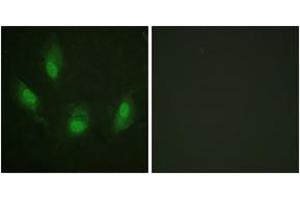 Immunofluorescence analysis of HeLa cells, using p53 (Ab-392) Antibody. (p53 抗体  (AA 344-393))