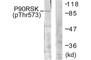 Western blot analysis of extracts from 293 cells treated with UV using p90 RSK (Phospho-Thr573) Antibody. (RPS6KA1 抗体  (pThr573))