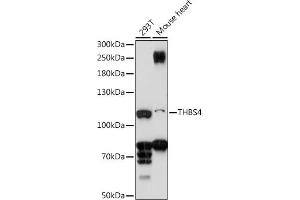 Western blot analysis of extracts of various cell lines, using THBS4 antibody (ABIN7270818) at 1:1000 dilution. (THBS4 抗体  (AA 27-300))