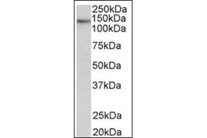 Staining of Skeletal Muscle lysate (35µg protein in RIPA buffer) using TERT antibody at 0. (TERT 抗体  (Internal Region))