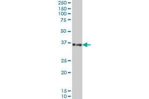 Western Blotting (WB) image for anti-Sorbitol Dehydrogenase (SORD) (AA 1-110) antibody (ABIN562952)