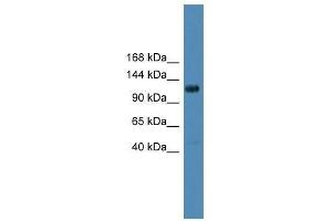 DGKQ antibody used at 0. (DGKQ 抗体  (Middle Region))