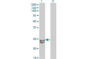 Western Blotting (WB) image for anti-RAB27A, Member RAS Oncogene Family (RAB27A) (AA 122-221) antibody (ABIN562560)