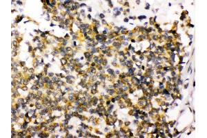 Immunohistochemistry (Paraffin-embedded Sections) (IHC (p)) image for anti-Discs, Large Homolog 4 (Drosophila) (DLG4) (AA 581-724) antibody (ABIN3043563) (DLG4 抗体  (AA 581-724))