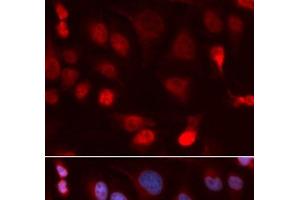 Immunofluorescence analysis of U2OS cells using ATP7B Polyclonal Antibody (ATP7B 抗体)
