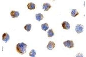 Immunohistochemistry (IHC) image for anti-Nerve Growth Factor Receptor (NGFR) antibody (ABIN1031777) (NGFR 抗体)