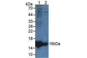 Figure. (LCNL1 抗体  (AA 2-164))