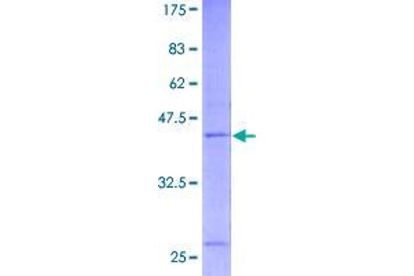 RNF24 Protein (AA 1-148) (GST tag)