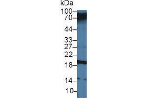 Western Blot; Sample: Human Serum; Primary Ab: 3µg/ml Rabbit Anti-Human CEACAM7 Antibody Second Ab: 0. (CEACAM7 抗体  (AA 147-231))