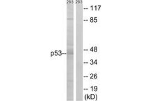 Western blot analysis of extracts from 293 cells, using p53 (Ab-46) Antibody. (p53 抗体  (AA 26-75))