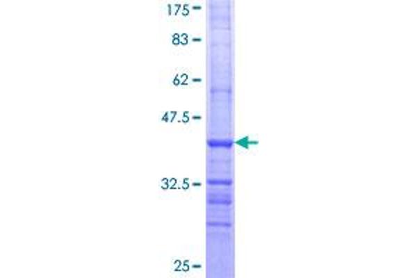 ALDH9A1 Protein (AA 173-270) (GST tag)