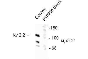 Western blots of rat brain homogenate showing specific immunolabeling of the ~125k voltage-gated potassium channel, Kv2. (Kv2.2 抗体)