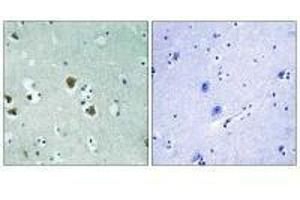 Immunohistochemistry analysis of paraffin-embedded human brain tissue using CRMP-2 (Ab-509) antibody. (DPYSL2 抗体  (Thr509))