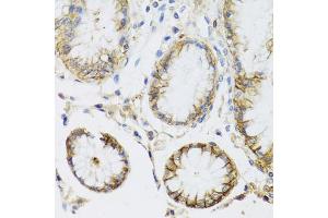 Immunohistochemistry of paraffin-embedded human stomach using ATP1A1 antibody (ABIN5970238) at dilution of 1/100 (40x lens). (ATP1A1 抗体)