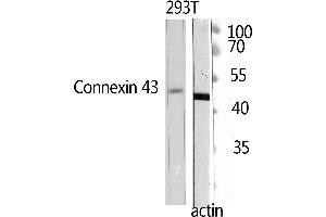 Western Blotting (WB) image for anti-Doublecortin (DCX) (Ser30) antibody (ABIN3184352) (Doublecortin 抗体  (Ser30))