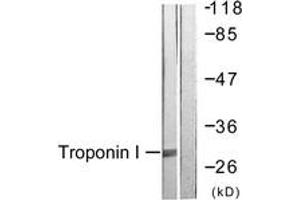 Western blot analysis of extracts from Jurkat cells, using TNNI3 (Ab-43) Antibody. (TNNI3 抗体  (AA 11-60))