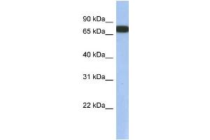 WB Suggested Anti-GNL3L Antibody Titration: 0. (GNL3L 抗体  (N-Term))