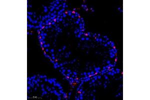 Immunofluorescence of paraffin embedded rat testis using kb12 (ABIN7075406) at dilution of 1:700 (260x lens) (p130 抗体)