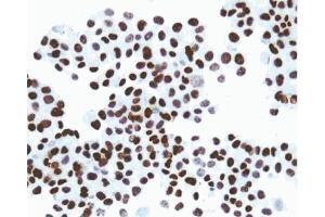 Immunohistochemical staining of SV40 large T, small t antigen. (SV40 Large T and Small Ts 抗体)