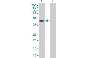 Lane 1: SPN transfected lysate ( 44. (SPN 293T Cell Transient Overexpression Lysate(Denatured))