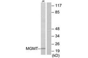 Western Blotting (WB) image for anti-O6-Methylguanine-DNA-Methyltransferase (MGMT) (AA 1-50) antibody (ABIN2890010) (MGMT 抗体  (AA 1-50))