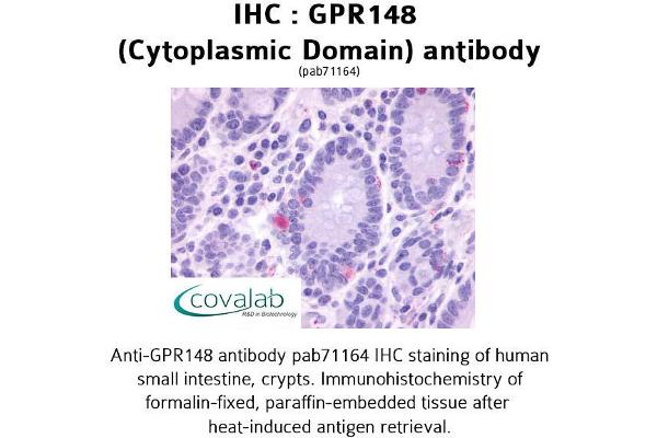 GPR148 抗体  (3rd Cytoplasmic Domain)