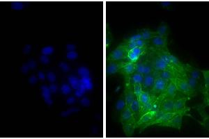 Human epithelial carcinoma cell line HEp-2 was stained with Mouse Anti-Human CD44-UNLB and DAPI. (山羊 anti-小鼠 IgG (Heavy & Light Chain) Antibody (FITC))
