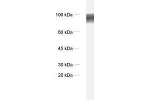 dilution: 1 : 1000, sample: synaptic membrane fraction of rat brain (LP1) (ADAM22 抗体)