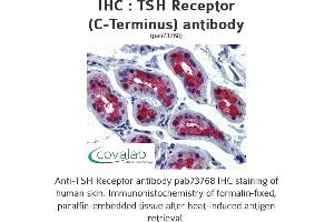 Image no. 1 for anti-Thyroid Stimulating Hormone Receptor (TSHR) (C-Term) antibody (ABIN1740418) (TSH receptor 抗体  (C-Term))