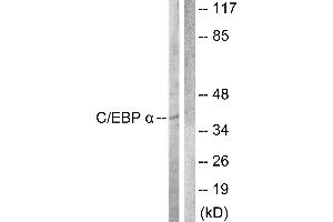 Western blot analysis of extracts from COS7 cells, treated with EGF (200ng/ml, 30mins), using C/EBP-α (Ab-222) antibody. (CEBPA 抗体  (Thr222))