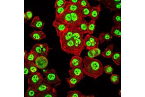 Immunocytochemistry (ICC) image for anti-Orthodenticle Homeobox 2 (OTX2) antibody (ABIN1845978) (OTX2 抗体)