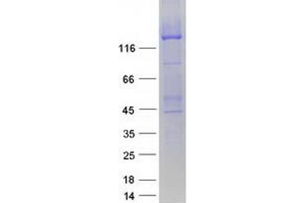 ABCC8 Protein (Myc-DYKDDDDK Tag)