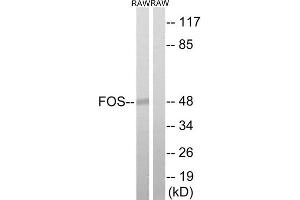 Western Blotting (WB) image for anti-c-Fos (c-Fos) (Thr232) antibody (ABIN1848286) (c-FOS 抗体  (Thr232))